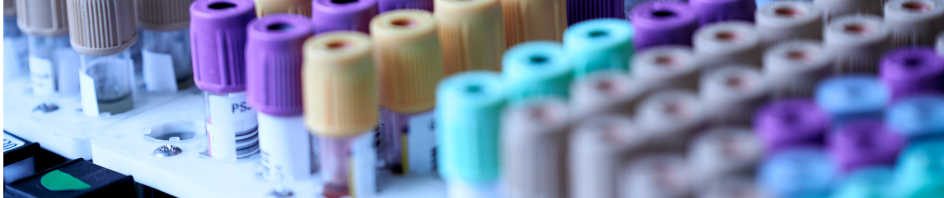 World-first clinical trial Most people Royal Brompton